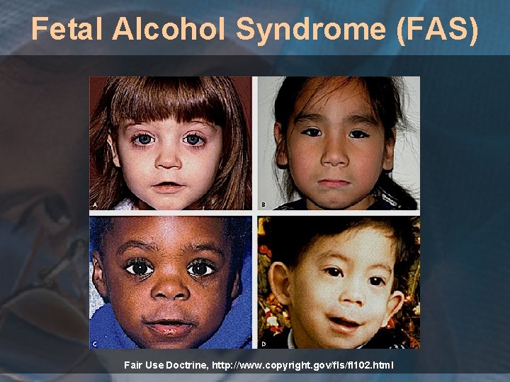 Fetal Alcohol Syndrome (FAS) Fair Use Doctrine, http: //www. copyright. gov/fls/fl 102. html 