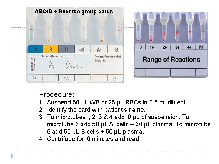 ABO/D + Reverse group cards Procedure: 1. Suspend 50 µL WB or 25 µL ABO/D + Reverse group cards Procedure: 1. Suspend 50 µL WB or 25 µL