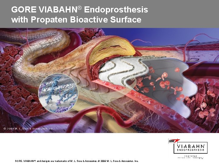 GORE VIABAHN® Endoprosthesis with Propaten Bioactive Surface GORE, VIABAHN ®, and designs are trademarks