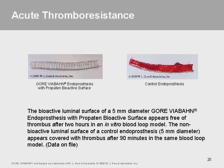 Acute Thromboresistance GORE VIABAHN® Endoprosthesis with Propaten Bioactive Surface Control Endoprosthesis The bioactive luminal