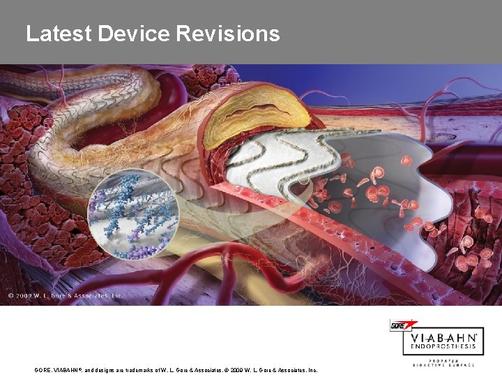 Latest Device Revisions GORE, VIABAHN ®, and designs are trademarks of W. L. Gore