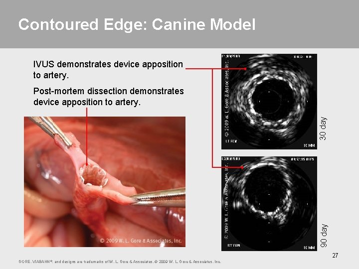 Contoured Edge: Canine Model IVUS demonstrates device apposition to artery. 90 day 30 day