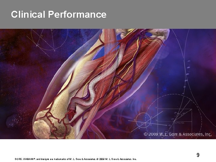Clinical Performance GORE, VIABAHN ®, and designs are trademarks of W. L. Gore &