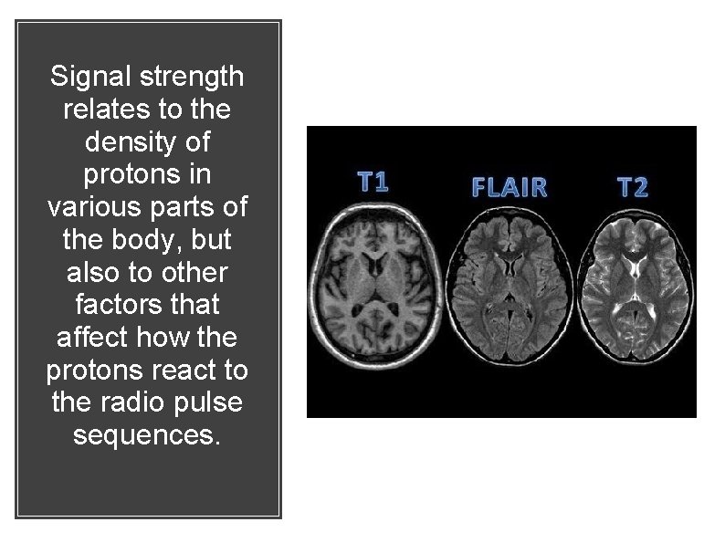 Signal strength relates to the density of protons in various parts of the body,