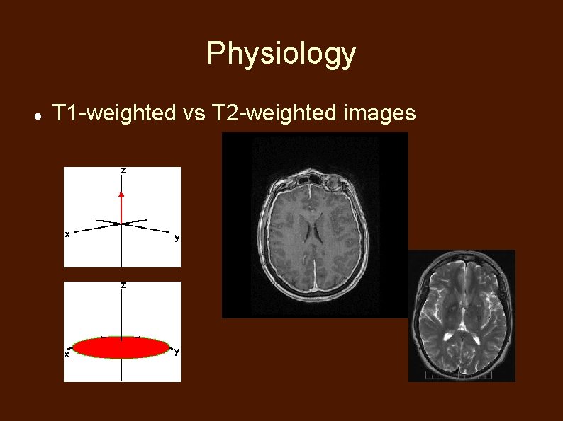 Physiology T 1 -weighted vs T 2 -weighted images 
