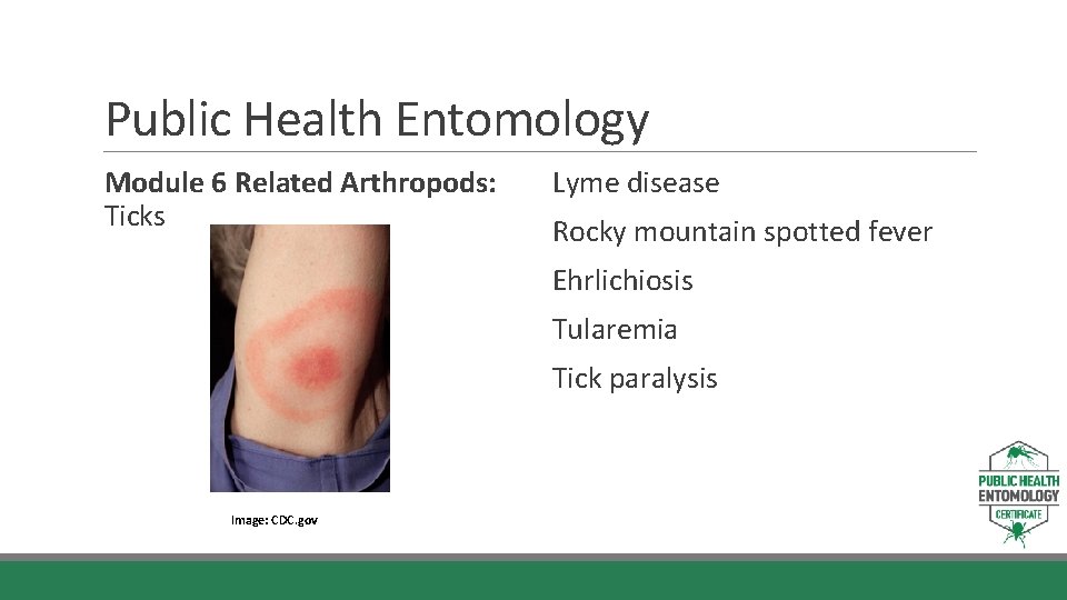 Public Health Entomology Module 6 Related Arthropods: Ticks Lyme disease Rocky mountain spotted fever