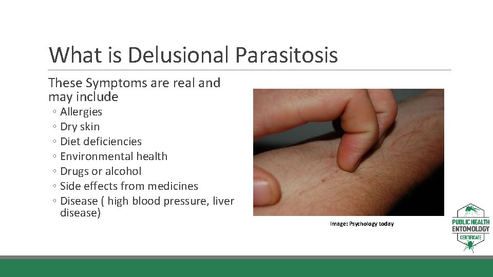 What is Delusional Parasitosis These Symptoms are real and may include ◦ Allergies ◦