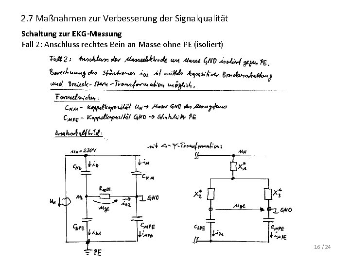 2. 7 Maßnahmen zur Verbesserung der Signalqualität Schaltung zur EKG-Messung Fall 2: Anschluss rechtes