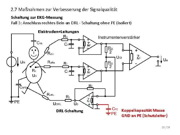 2. 7 Maßnahmen zur Verbesserung der Signalqualität Schaltung zur EKG-Messung Fall 3: Anschluss rechtes