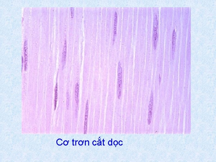 Cơ trơn cắt dọc 