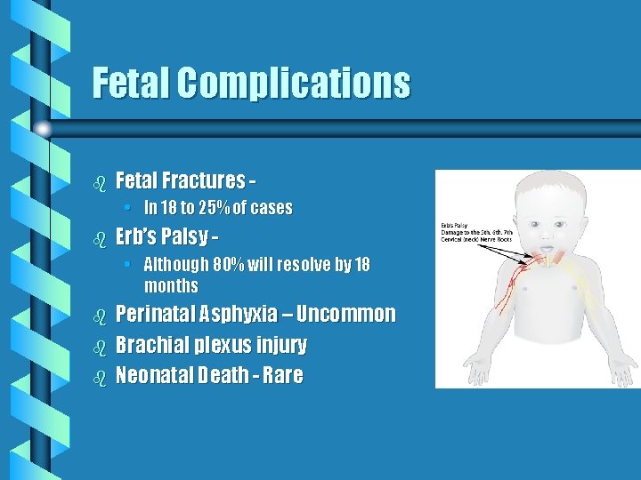 Fetal Complications b Fetal Fractures • In 18 to 25% of cases b Erb’s