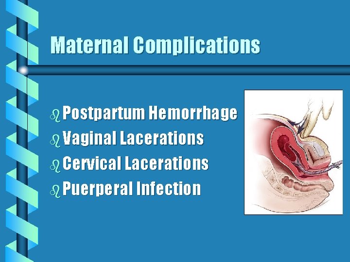 Maternal Complications b Postpartum Hemorrhage b Vaginal Lacerations b Cervical Lacerations b Puerperal Infection