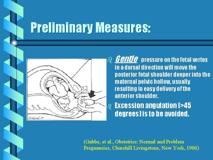 Preliminary Measures: b b Gentle pressure on the fetal vertex in a dorsal direction