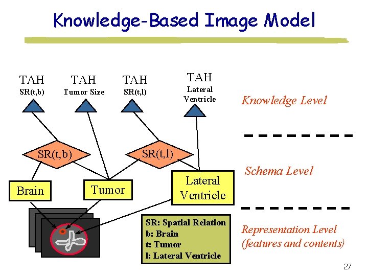 Knowledge-Based Image Model TAH TAH SR(t, b) Tumor Size SR(t, l) Lateral Ventricle Knowledge