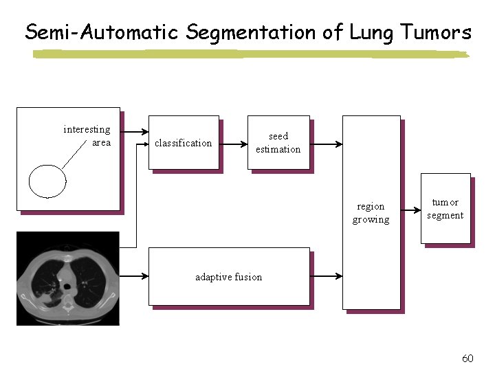 Semi-Automatic Segmentation of Lung Tumors interesting area classification seed estimation region growing tumor segment