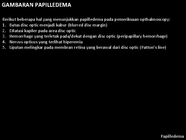 GAMBARAN PAPILLEDEMA Berikut beberapa hal yang menunjukkan papilledema pada pemeriksaan opthalmoscopy: 1. Batas disc