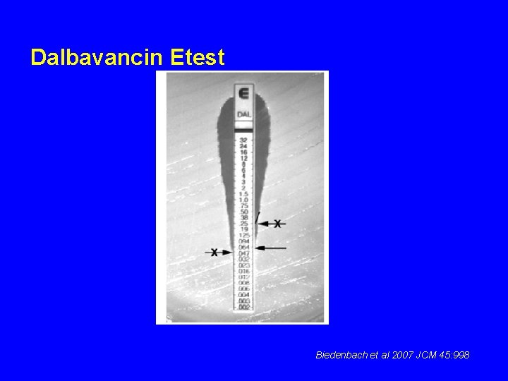 Dalbavancin Etest Biedenbach et al 2007 JCM 45: 998 