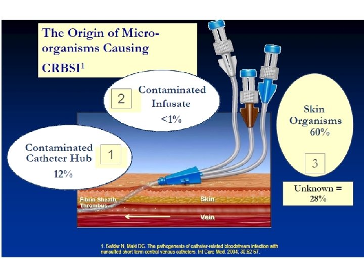 Impact of Primary BSI Pathophysiology of Catheter Related