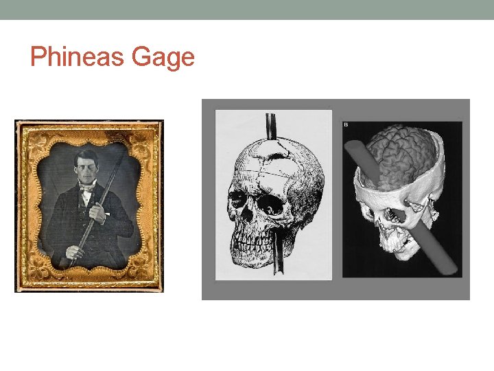 Phineas Gage 