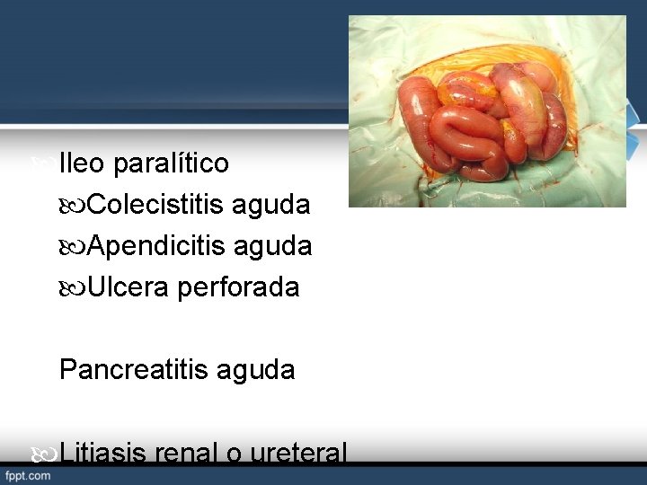  Ileo paralítico Colecistitis aguda Apendicitis aguda Ulcera perforada Pancreatitis aguda Litiasis renal o