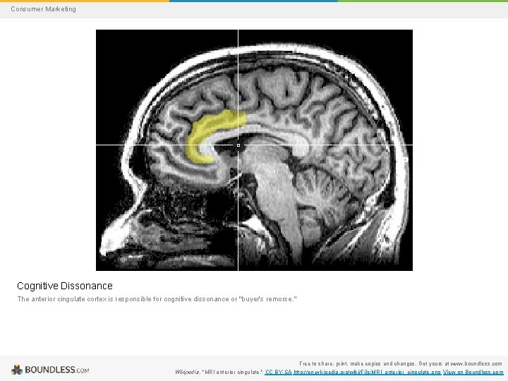 Consumer Marketing Cognitive Dissonance The anterior cingulate cortex is responsible for cognitive dissonance or