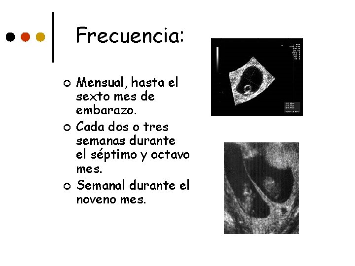 Frecuencia: ¢ ¢ ¢ Mensual, hasta el sexto mes de embarazo. Cada dos o