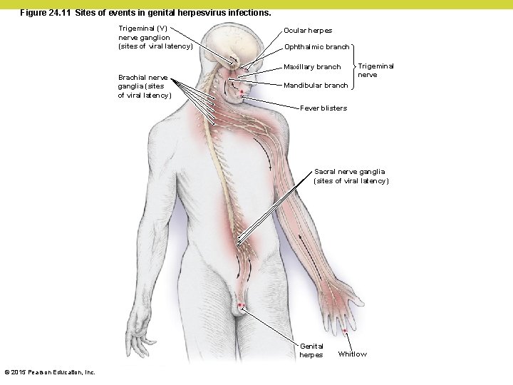 Figure 24. 11 Sites of events in genital herpesvirus infections. Trigeminal (V) nerve ganglion
