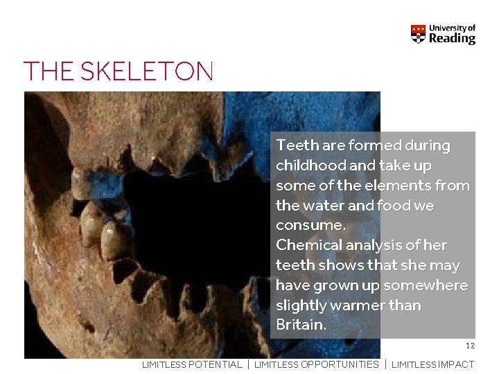 THE SKELETON Teeth are formed during childhood and take up some of the elements