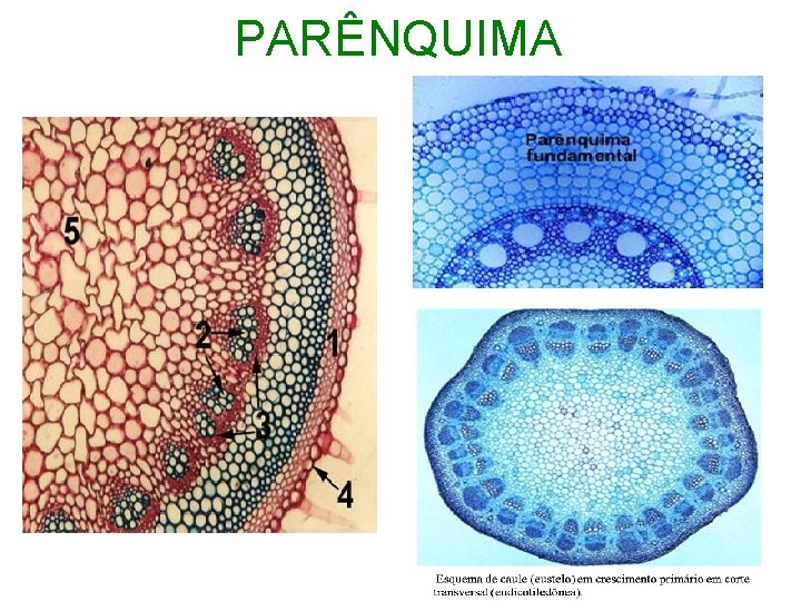 PARÊNQUIMA 