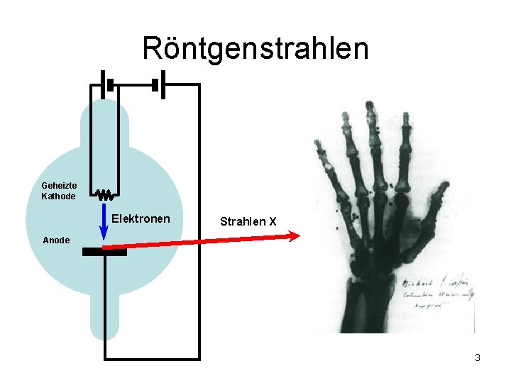 Röntgenstrahlen Geheizte Kathode Elektronen Strahlen X Anode 3 