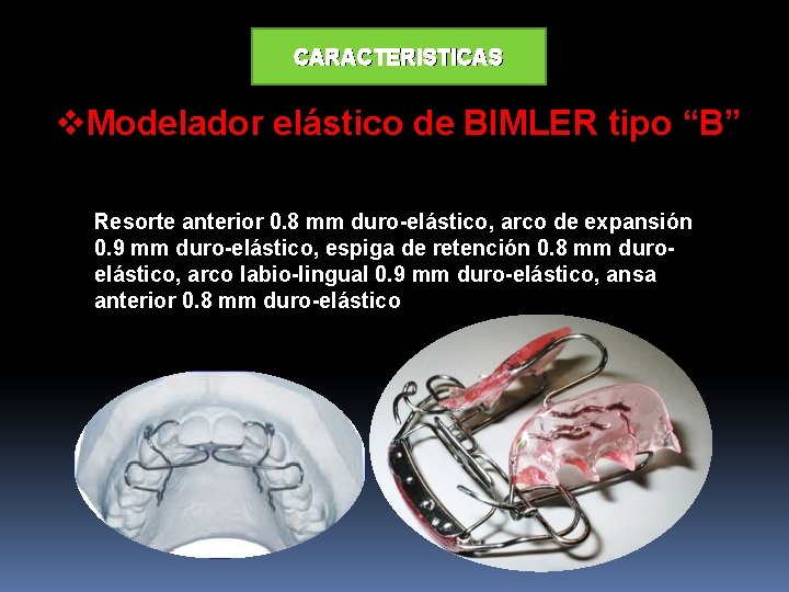 CARACTERISTICAS v. Modelador elástico de BIMLER tipo “B” Resorte anterior 0. 8 mm duro-elástico,