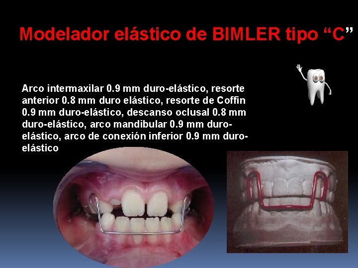 Modelador elástico de BIMLER tipo “C” Arco intermaxilar 0. 9 mm duro-elástico, resorte anterior