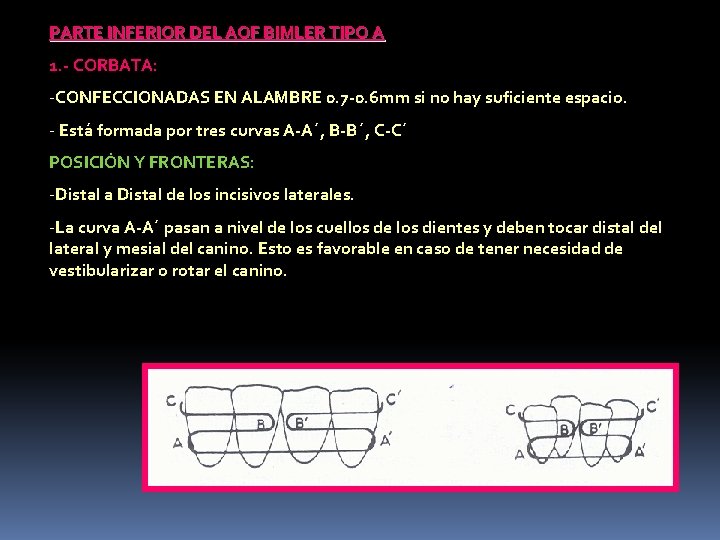PARTE INFERIOR DEL AOF BIMLER TIPO A 1. - CORBATA: -CONFECCIONADAS EN ALAMBRE 0.