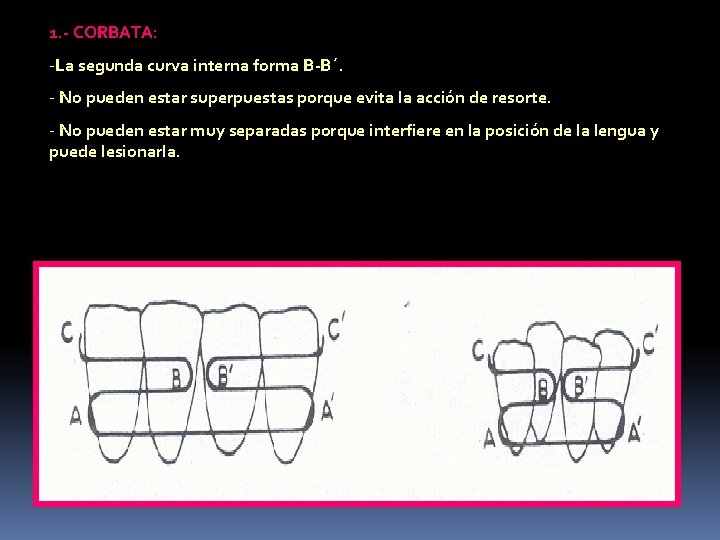 1. - CORBATA: -La segunda curva interna forma B-B´. - No pueden estar superpuestas