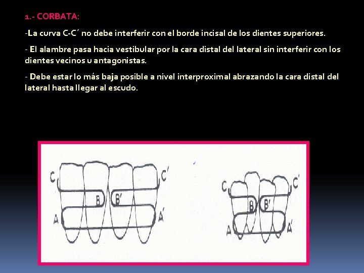 1. - CORBATA: -La curva C-C´ no debe interferir con el borde incisal de