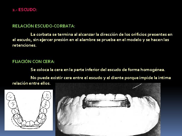 2. - ESCUDO: RELACIÓN ESCUDO-CORBATA: La corbata se termina al alcanzar la dirección de