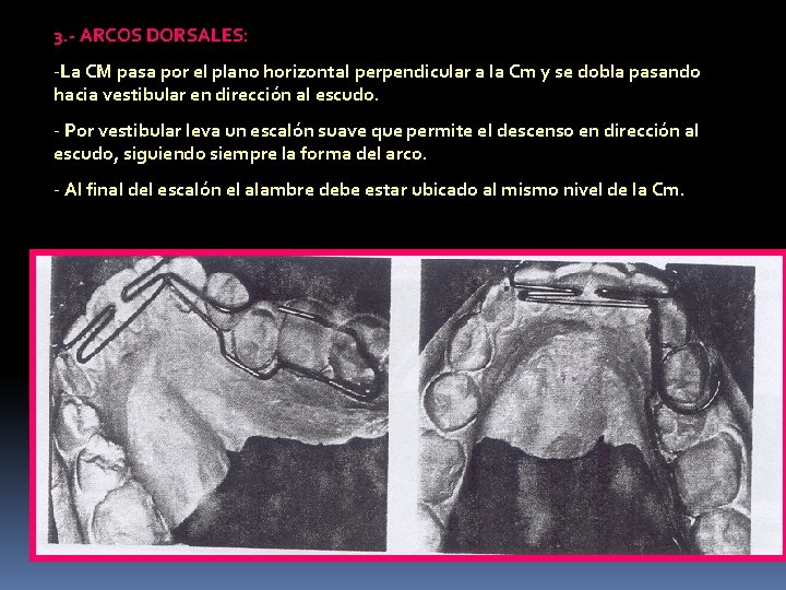 3. - ARCOS DORSALES: -La CM pasa por el plano horizontal perpendicular a la