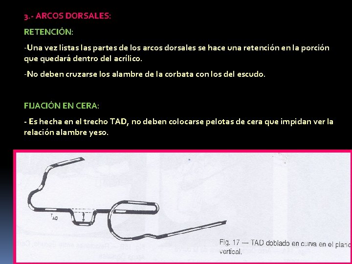 3. - ARCOS DORSALES: RETENCIÓN: -Una vez listas las partes de los arcos dorsales