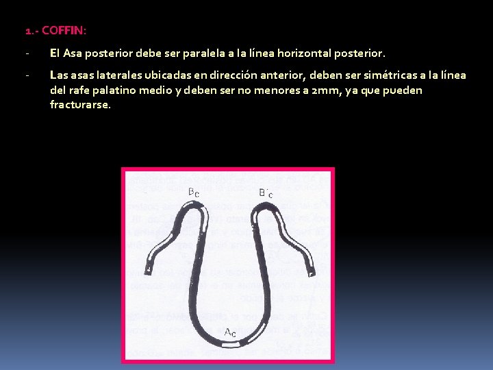 1. - COFFIN: - El Asa posterior debe ser paralela a la línea horizontal