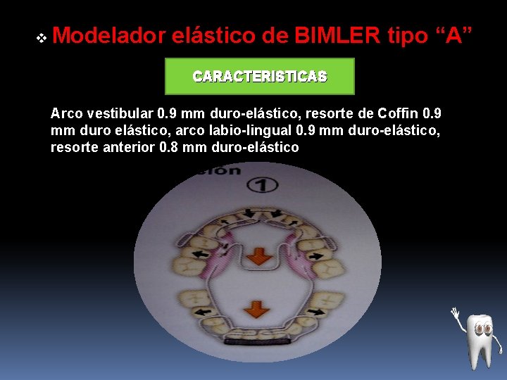 v Modelador elástico de BIMLER tipo “A” CARACTERISTICAS Arco vestibular 0. 9 mm duro-elástico,