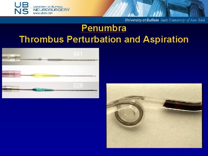Penumbra Thrombus Perturbation and Aspiration 041 032 026 