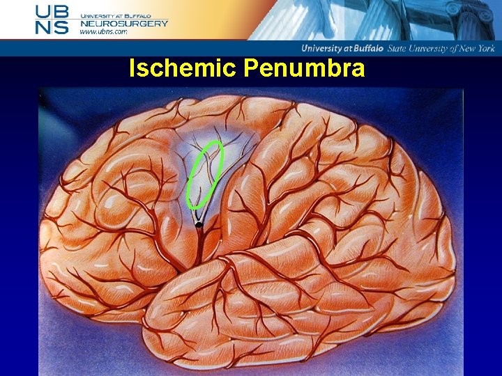 Ischemic Penumbra 