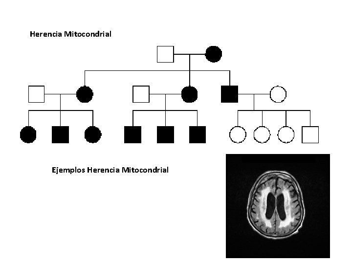 Herencia Mitocondrial Ejemplos Herencia Mitocondrial 