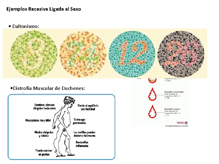 Ejemplos Recesiva Ligada al Sexo • Daltonismo: • Hemofilia: • Distrofia Muscular de Duchenes: