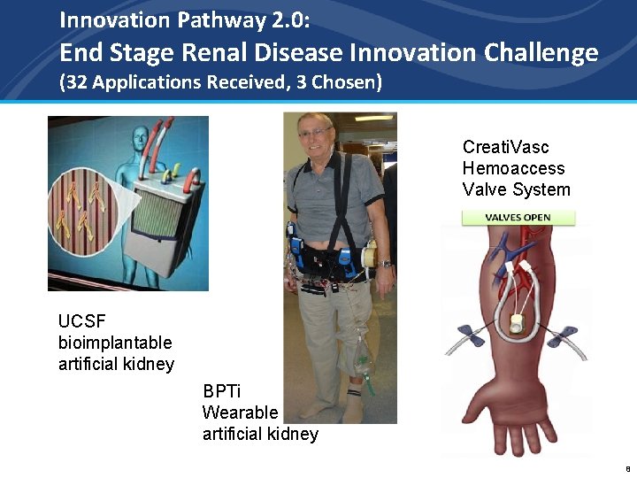 Innovation Pathway 2. 0: End Stage Renal Disease Innovation Challenge (32 Applications Received, 3