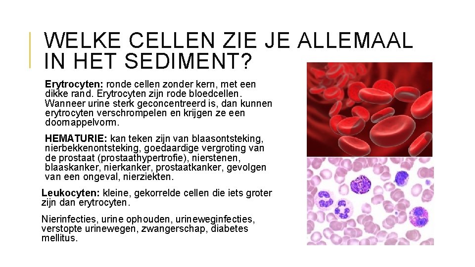 LABORATORIUMWERK Urinesediment wat zit er allemaal in en
