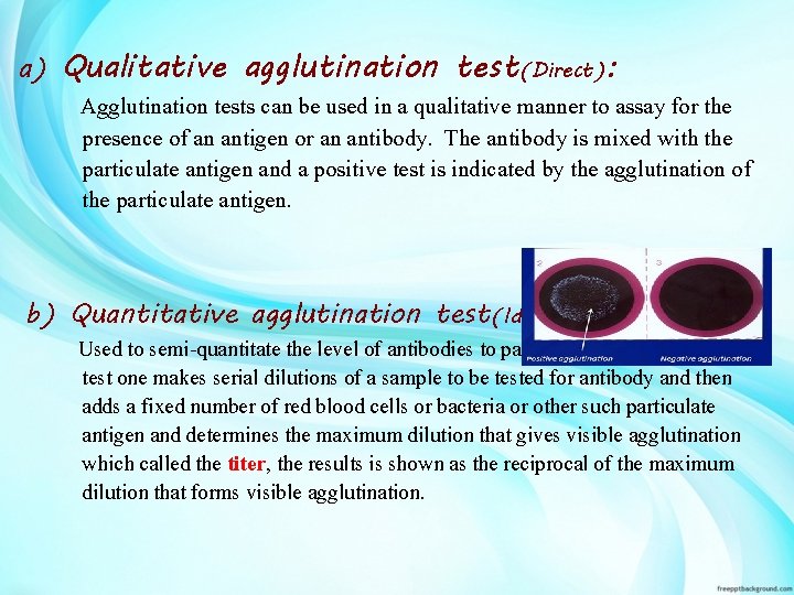 a) Qualitative agglutination test(Direct): Agglutination tests can be used in a qualitative manner to