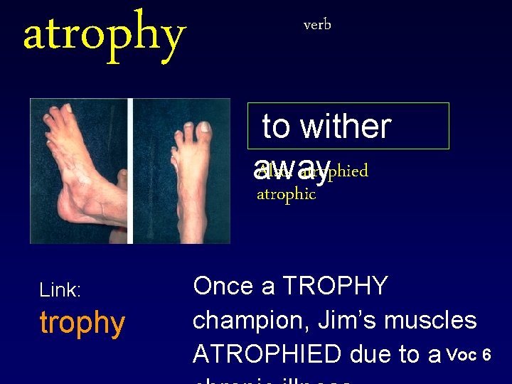 atrophy verb to wither Also: atrophied away atrophic Link: trophy Once a TROPHY champion,