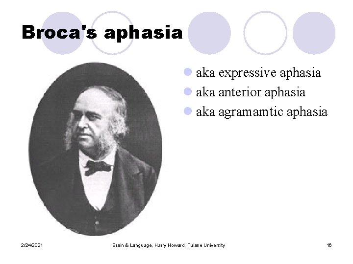 Broca's aphasia l aka expressive aphasia l aka anterior aphasia l aka agramamtic aphasia