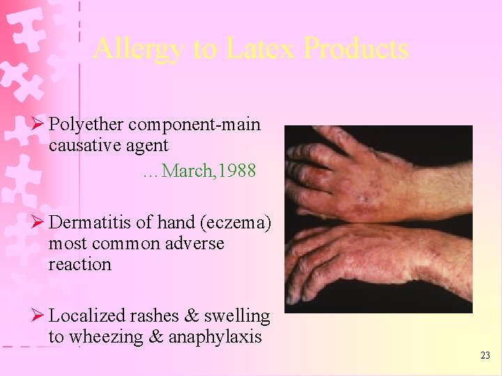 Allergy to Latex Products Ø Polyether component-main causative agent …March, 1988 Ø Dermatitis of